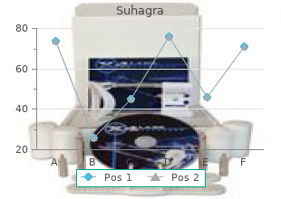 cheap suhagra 100mg on-line