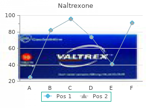 best naltrexone 50 mg