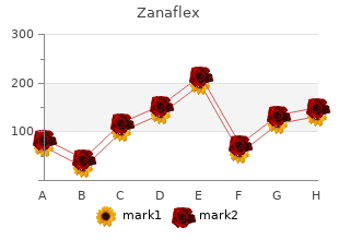 buy zanaflex 2mg with mastercard