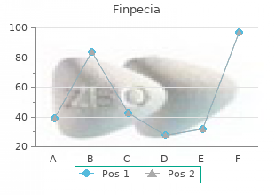 generic finpecia 1mg without a prescription