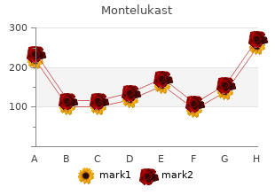 purchase montelukast on line amex
